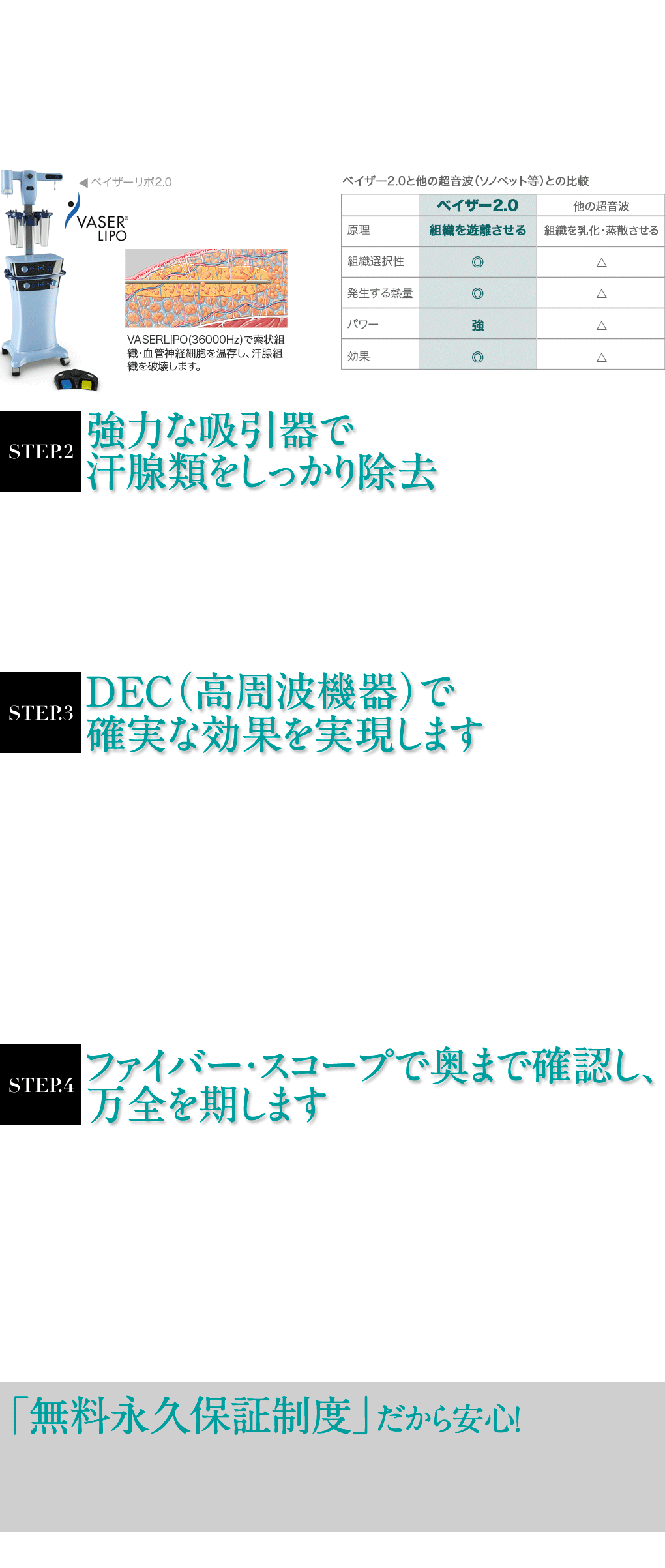 強力な吸引器で汗腺類をしっかり除去/DEC（高周波機器）で確実な効果を実現します/ファイバー・スコープで奥まで確認し、万全を期します