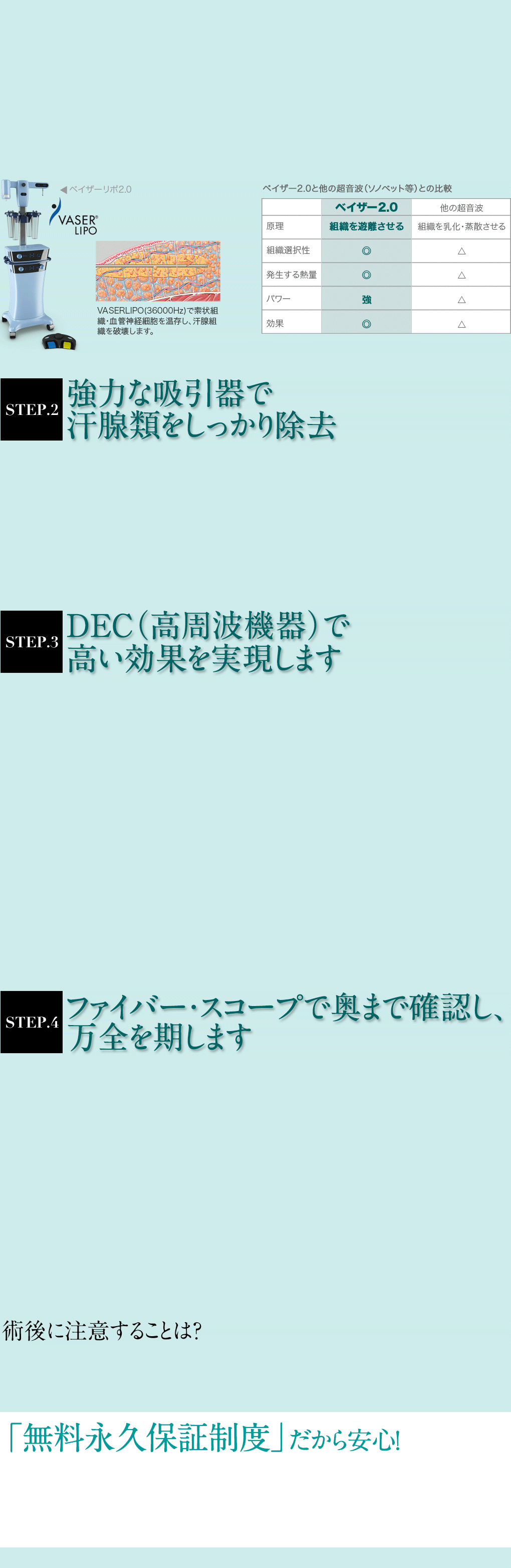 強力な吸引器で汗腺類をしっかり除去/DEC（高周波機器）で確実な効果を実現します/ファイバー・スコープで奥まで確認し、万全を期します