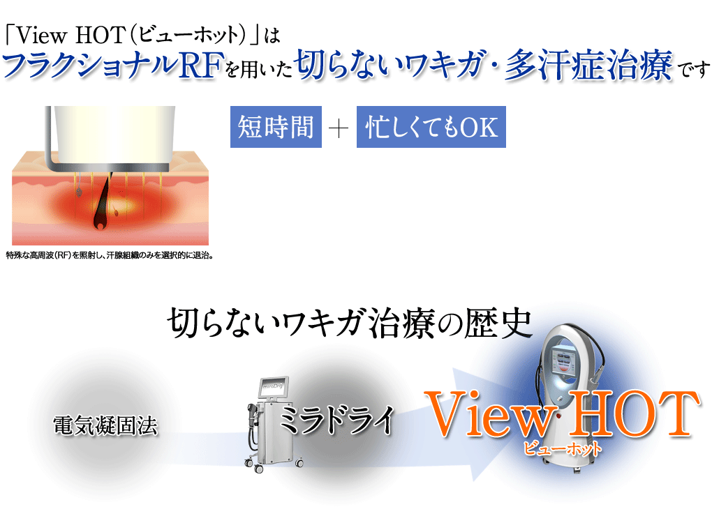 ベイザー超音波による確実な治療